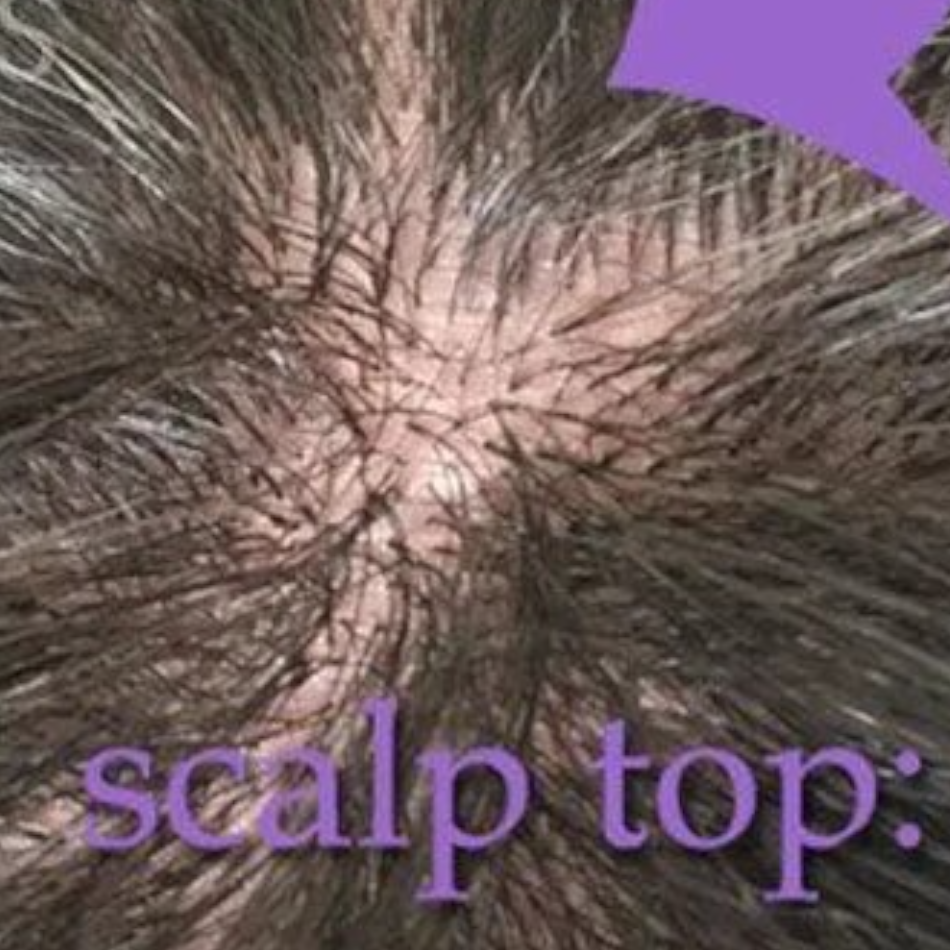 Thumbnail: Kinky Curl Full Machine Made Scalp Top Wig with Bangs – 150% Density Virgin Braz