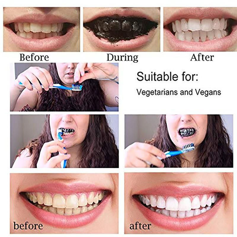 Miniatura: 483 Carbon Activado 30g Blanqueamiento Dental
