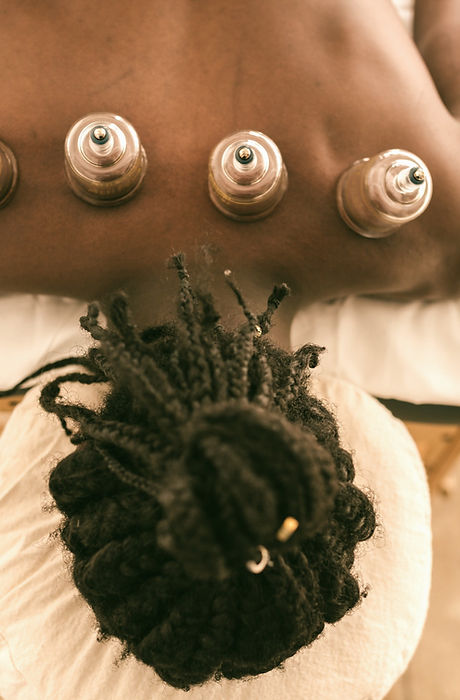 Cupping Therapy_edited.jpg