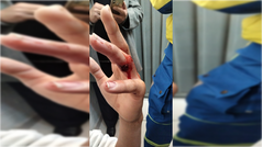 Menor de 12 años se autodispara en secundaria de Iztapalapa
