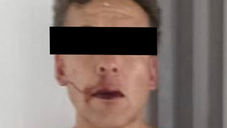 Lo señalan de disparar contra una mujer en Iztapalapa y lo detienen