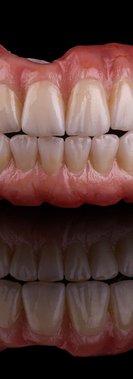 Absolute Dental Lab Photography