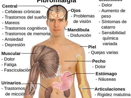 FIBROMIALGIA