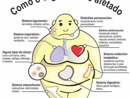 OBESIDADE