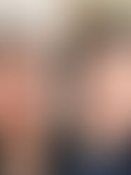 Get Glowing With The VI Peel