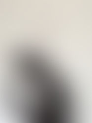 The Aesthetic Chronicles: Why Loyalty to Your Injector is a Game-Changer!