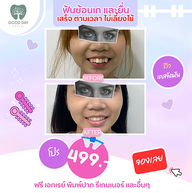 4.png