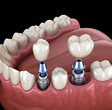 istockphoto-1413573936-612x612.jpg