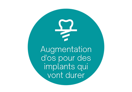 Implant video (4).png