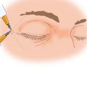 anesthesia.png