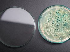 Bakteriyel Plasmid DNA İzolasyonu