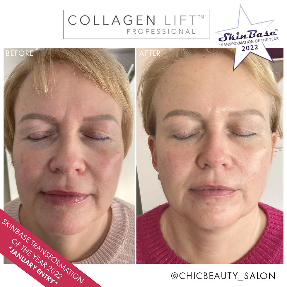Collagen Lift Facial