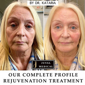 Complete Profile Rejuvenation Dr. Kataria JUVAL Medical