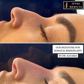 Complete Profile Rejuvenation Dr. Kataria JUVAL Medical