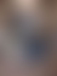 Anesthesia Machine |  Chirana | Anemat   N7