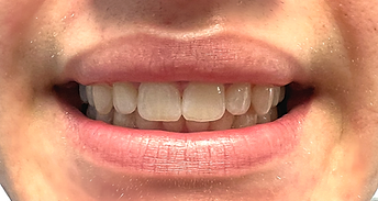 patient post-op photo