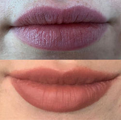 Lip Treatments
