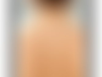 selän ihonpuhdistus ultraääni ammattilaisella Pasilan Hiuspiste & Kauneushoitola Helsinki