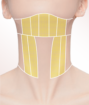 Ulthera-05.png