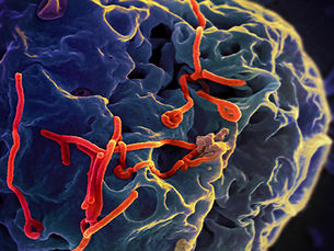 Vertuscht: Auch Ebola kommt aus dem Labor