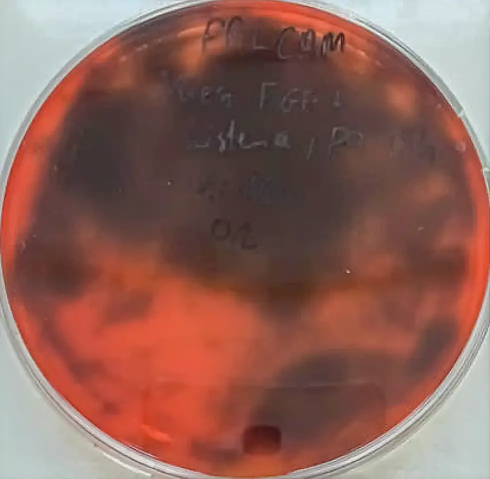 Constructive-Microbes-Get-Rid-Of-Listeria-Fig-1-2.webp