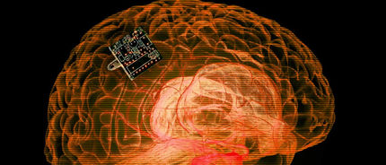 A Company Wants to Put a Chip in Your Brain to Cure Disease