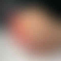 Gel Polish (Shellac Manicure)