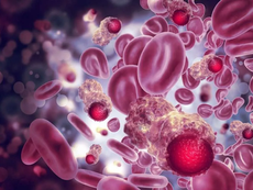 Estudios vinculan la mala salud oral con el cáncer de páncreas