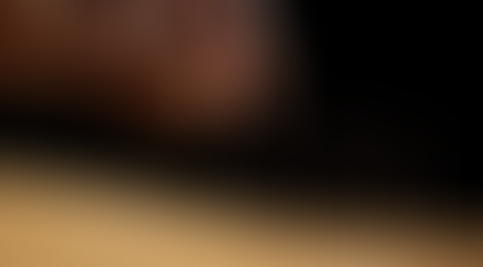 Straight to the point of dry needling