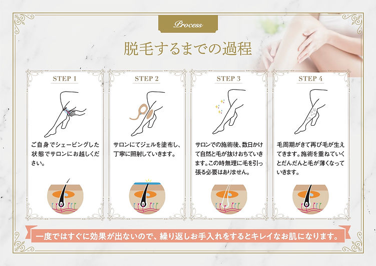 脱毛するまでの過程