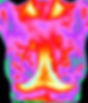 Thermography Breast Health Scan