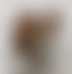 Food Sensitivity Testing