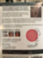 Thumbnail: Ear Seed Kits