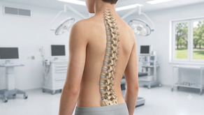 Vertebral Body Tethering (VBT)