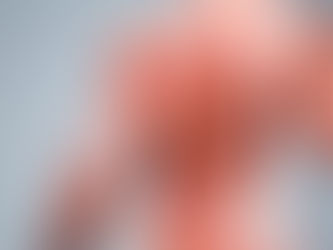 Desequilíbrio Muscular na Escoliose Idiopática do Adolescente: O Que Mostram os Exames de Imagem?