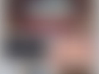 Occlusal splint for teeth grinding.