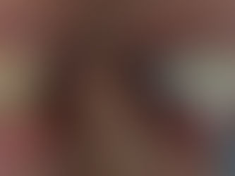 Tetracycline-stained teeth whitening