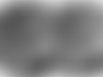 Apicoectomy - root canal surgery.