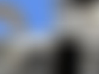 Dental implant 3D planning