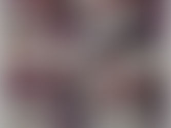 Toothbrush abrasion.