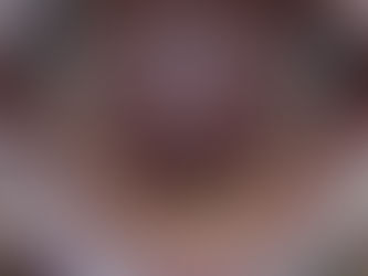 Get rid of thumb sucking habit.