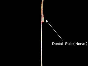 This is where toothache comes from.
