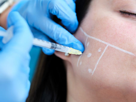Know More About Dermal Injection Fillers and How They Work