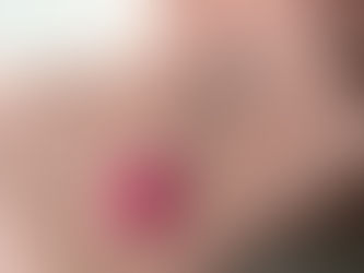 Januar-Loch oder kleine Löcher filzen