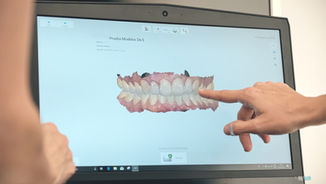Digitalización dental como sinónimo de calidad: trabaja con Ytrio.