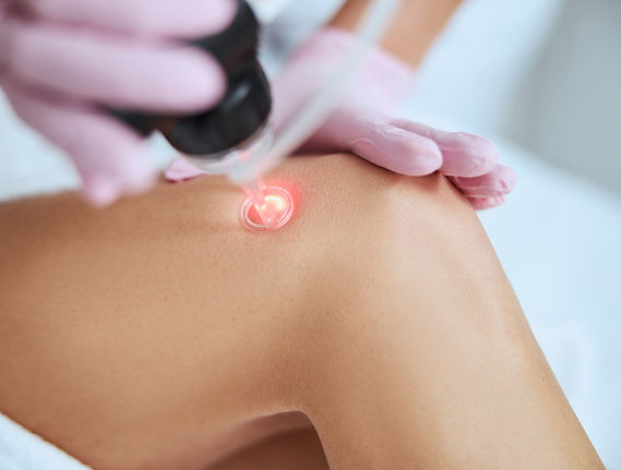 vascular-laser-experienced-dermatologist-treating-her-patient-with-the-laser.jpeg