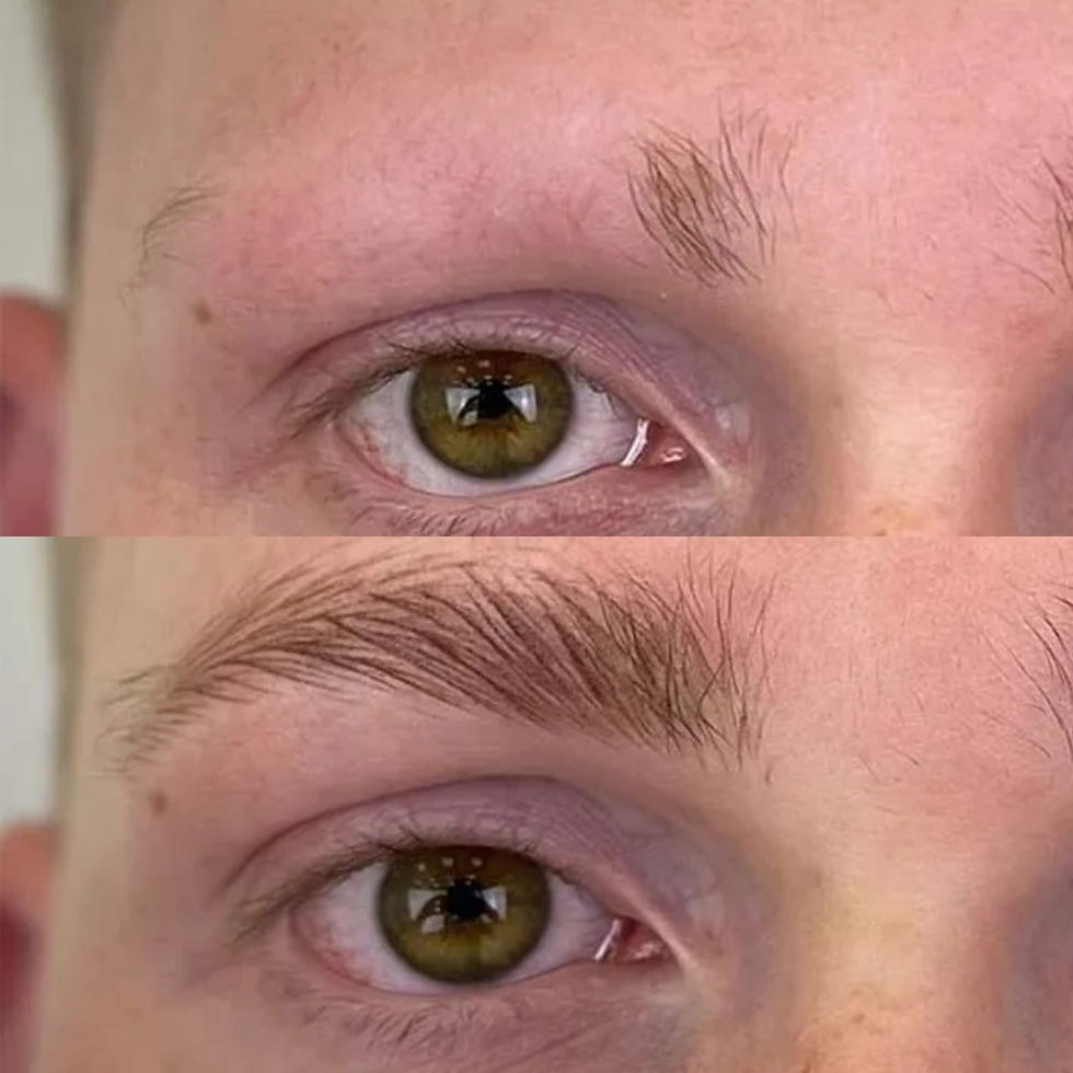 Micropigmentação sobrancelhas - capilar alopecia ou quimioterapia