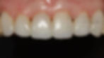 Estetica dental después