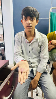 A boy sits on a clinic stool wearing no shoes.