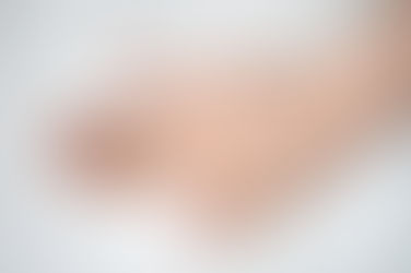 What to do About a Finger Dislocation